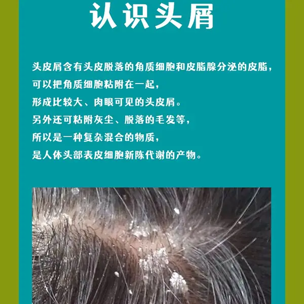 护理头发专业术语_护理头发专业学什么_专业头发护理2