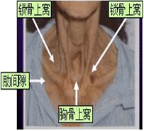 主管考试软件护师怎么考_主管护师考试题库软件_主管护师考试的软件