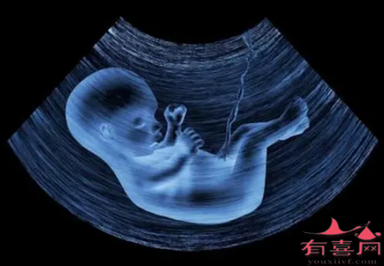 喝酒后能查甲功五项吗_喝酒查甲功能有影响么_酒后可以抽血化验甲功吗