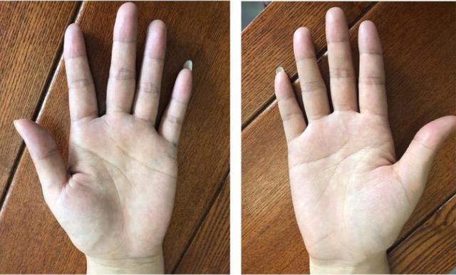 拳头手_握紧拳头30秒 看看你有哪些病_少女病有100种