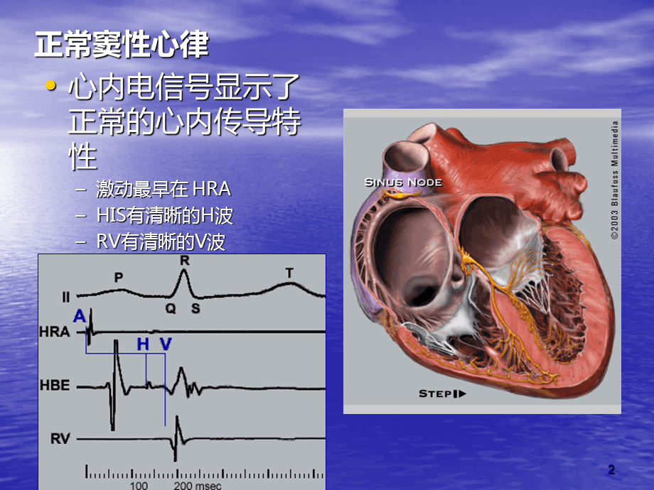 阵发性室上性心动过速/治疗_阵发性房动心动过速_阵发性房性心动