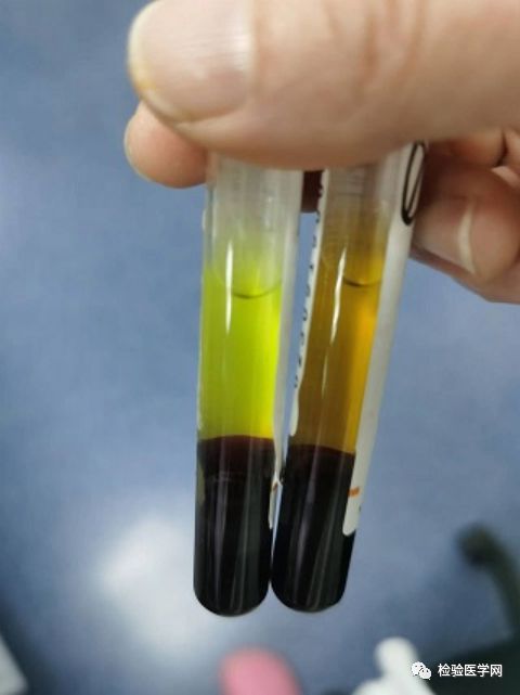 480毫升血浆_一袋400毫升血浆多少钱_400ml血浆等于多少单位